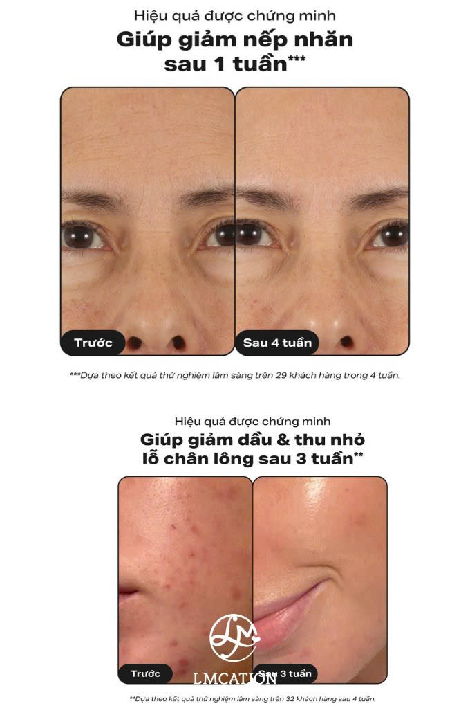 Deep Exfoliating Liquid – Helps Treat Blemishes & Control Excess Oil, Authentic U.S. Product